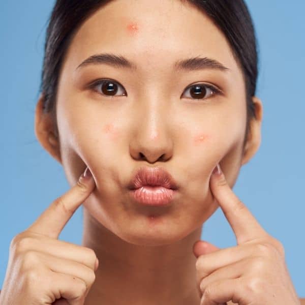 Cómo cuidar la piel después de una limpieza facial